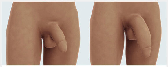 Como agrandar el pene en 2025 si estas en guatemala